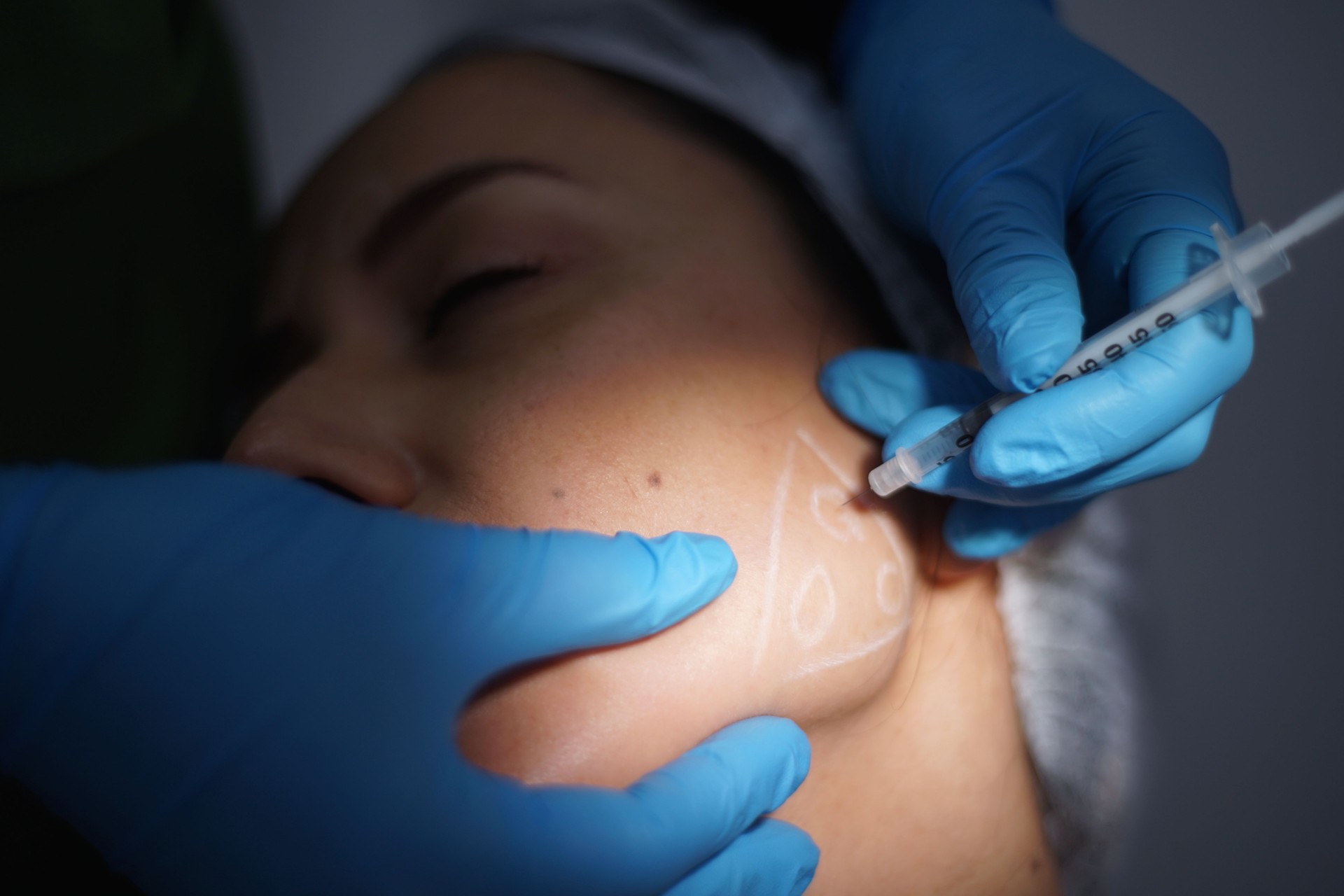 Facial aesthetics surgery treatment